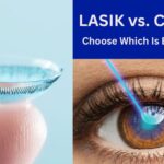 Lasik vs Contacts Choose Which Is Best For You